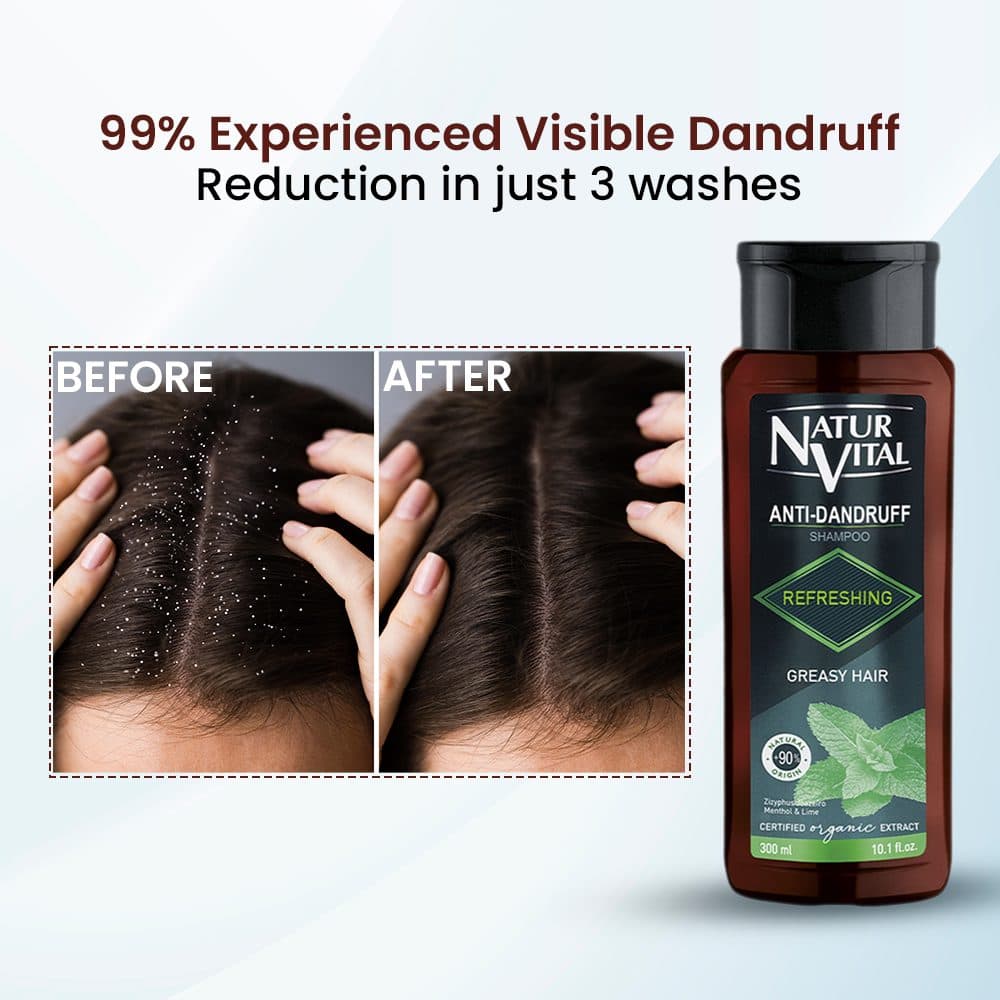 Anti Dandruff Shampoo(Refreshing- Greasy Hair) image 7