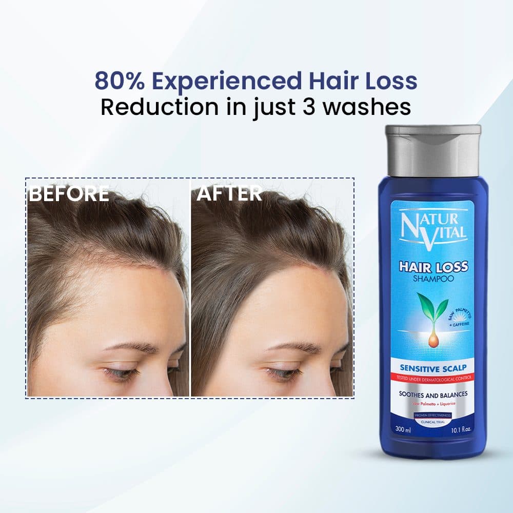 Hair Loss Shampoo(Sensitive Scalp) image 7