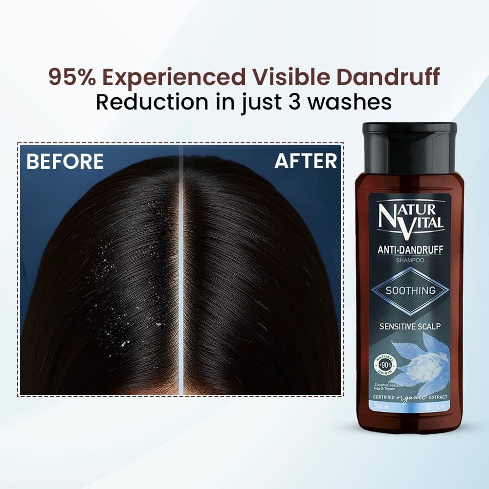 Anti Dandruff Shampoo(Soothing Sensitive Scalp) image 7