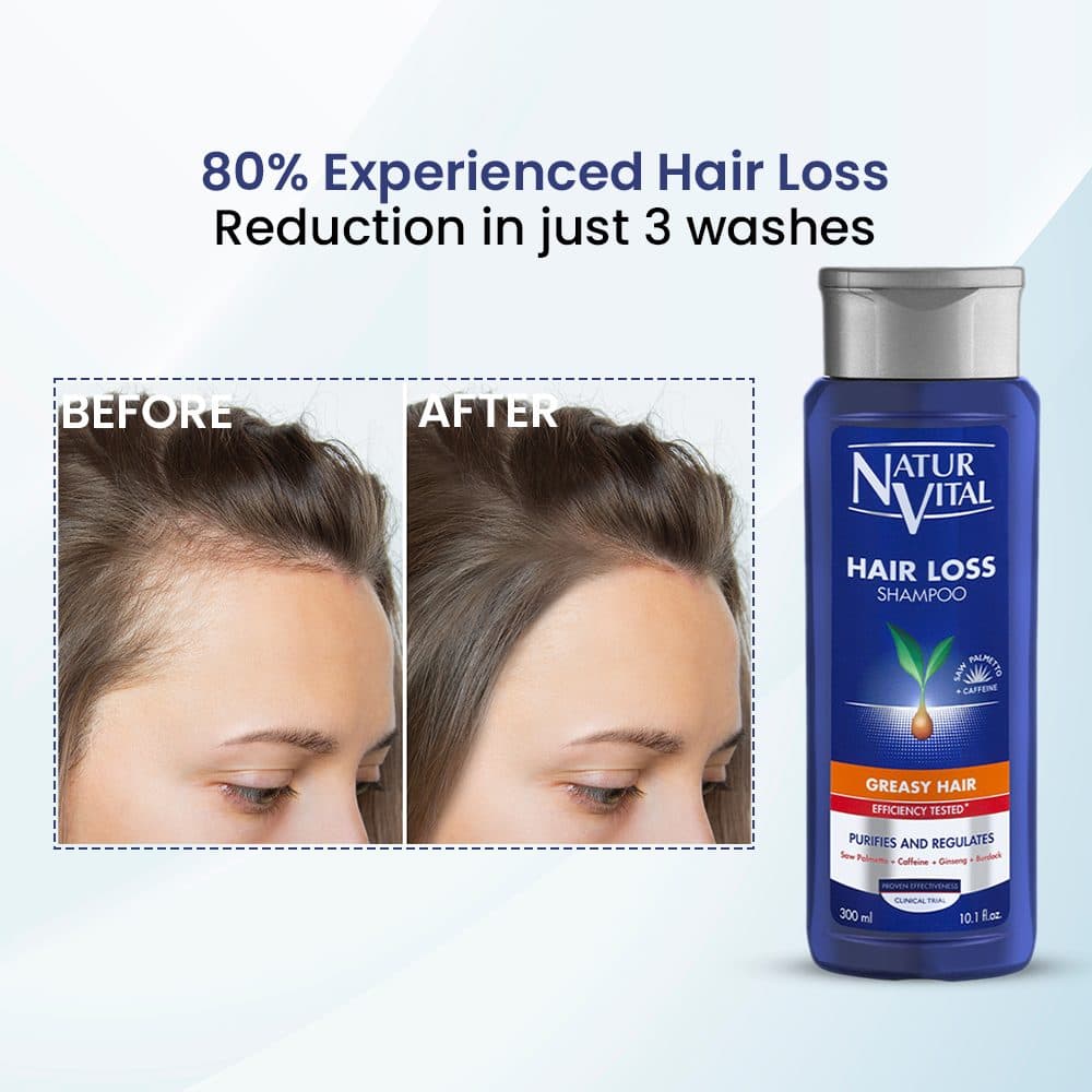 Hair Loss Shampoo(Greasy Hair) image 7