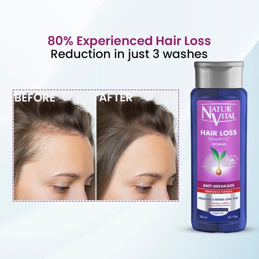 Hair Loss Shampoo Woman(Anti breakage) image 7